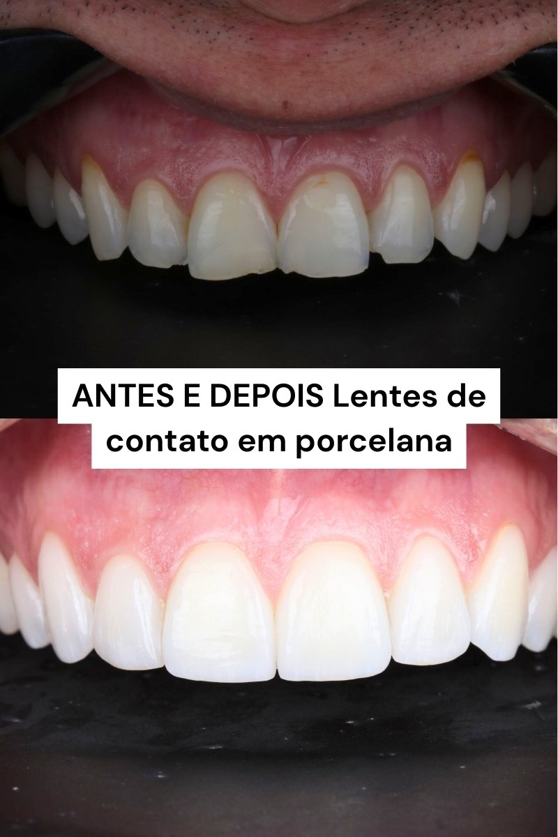 Dentista Moca
