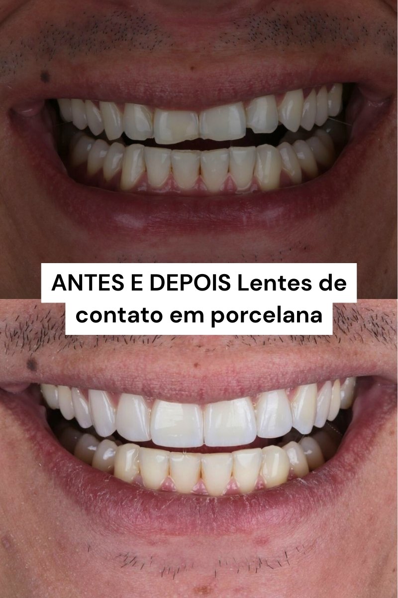 Dentista Moca